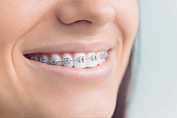 Best Full Mouth Reconstruction  in Sumner, IL